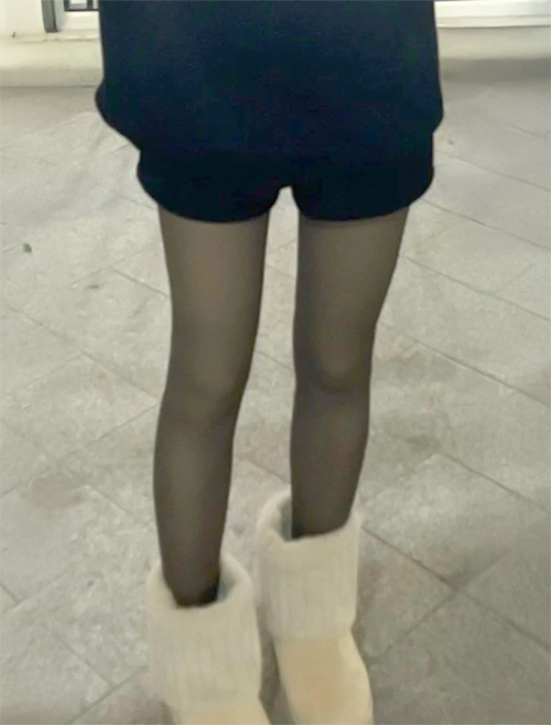 After thigh liposuction photo of hmemend showing slim legs in Korea.