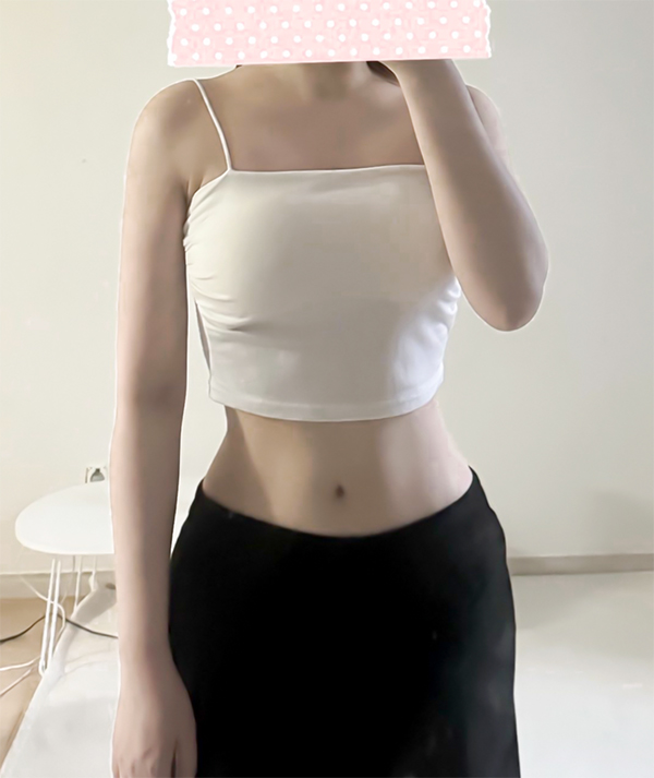 after photo showing lucia00's flat stomach and toned arms post liposuction in Korea