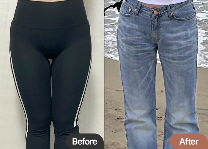 thigh-liposuction-thumbnail-selfie-xxxxee