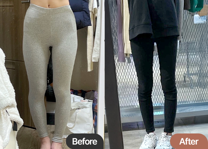 thigh-liposuction-thumbnail-selfie-yeulgottok
