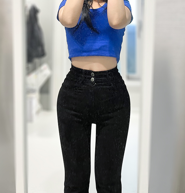 unniRY4fd2's abdominal and thigh liposuction after photo showing improved bodyline in Korea.
