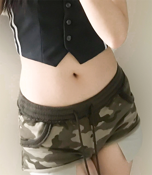 Before photo of pingpong89 showing visible belly fat before abdominal liposuction at Lesarts Plastic Surgery in Korea.