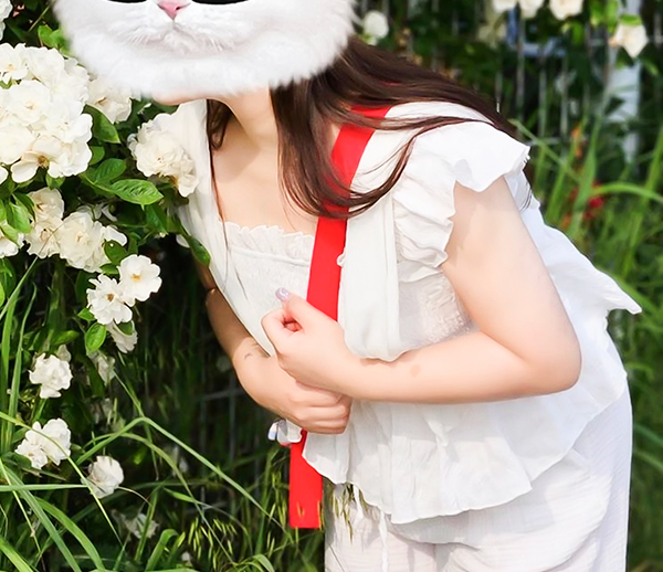 unniDOiTfz after arm liposuction for wedding prep at Lesarts Plastic Surgery in Korea.