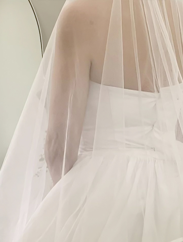 unniWxeOIK after arm liposuction, in wedding dress at Lesarts Plastic Surgery