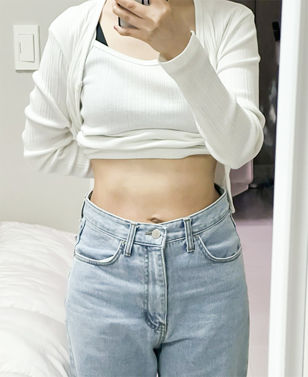 After photo of unniXGwrar showing toned flat abdomen and defined waistline post liposuction in Korea.