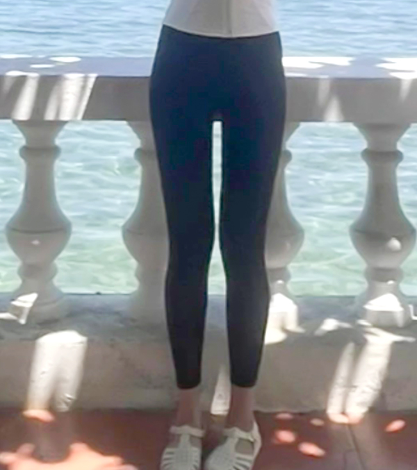 vvv22’s thighs visibly slimmer after liposuction at Lesarts Plastic Surgery in Korea