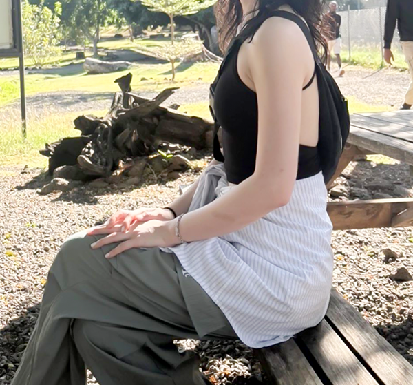 Second after photo from yeonyeonyeonyeong showing relaxed sleeveless posture outdoors after arm liposuction.