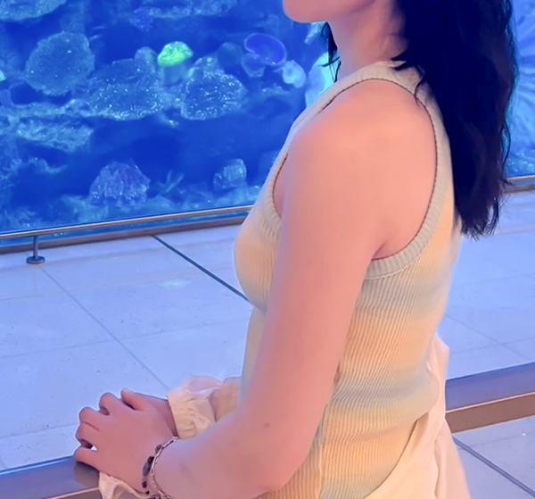 After photo showing slim and toned arms post liposuction from yeonyeonyeonyeong wearing sleeveless top.