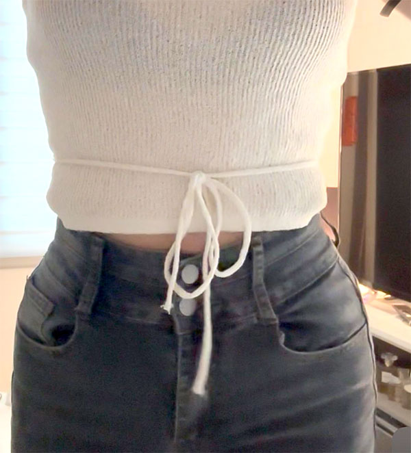 Loroppungppangyi slim waistline after abdominal liposuction with love handles removed at best plastic surgery clinic in Gangnam