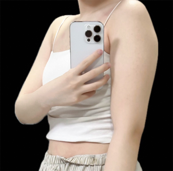 Nyeoeongha upper arm fat and accessory breast before liposuction at best clinic in Gangnam
