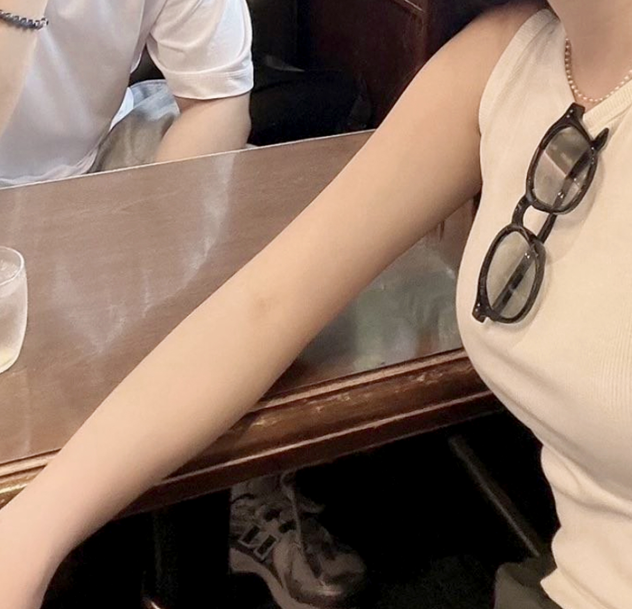 Cheokjjejjje arm liposuction 4 months after surgery in Gangnam Korea – Lesarts Plastic Surgery