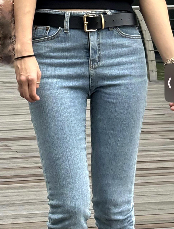 Gugugugde inner thigh liposuction after photo in Korea – Lesarts Plastic Surgery