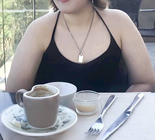 Rikka arm liposuction before photo in Korea – Lesarts Plastic Surgery