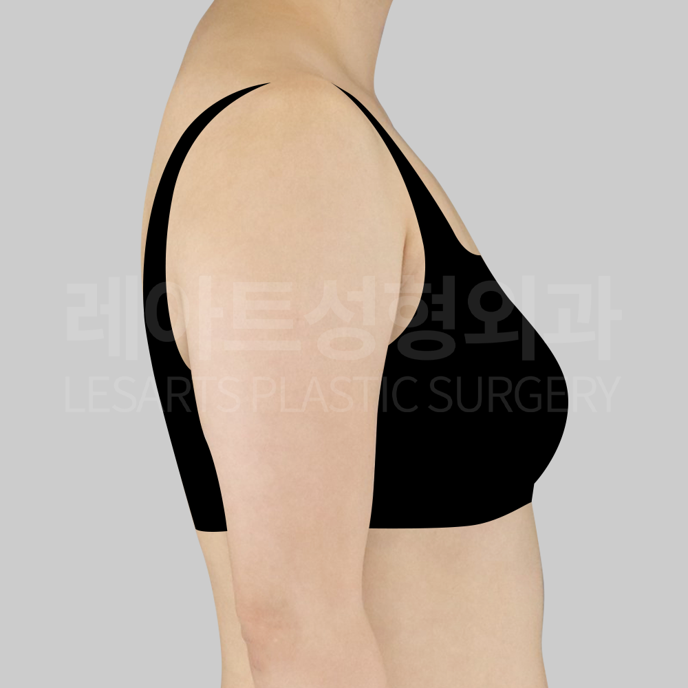 09-1_09_30313_before_side