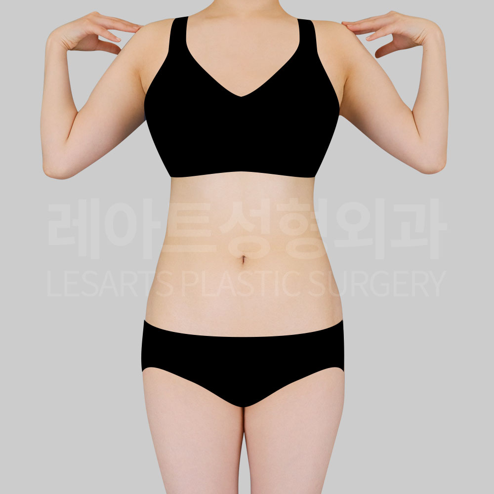 1_29075_abs_pelvic_liposuction