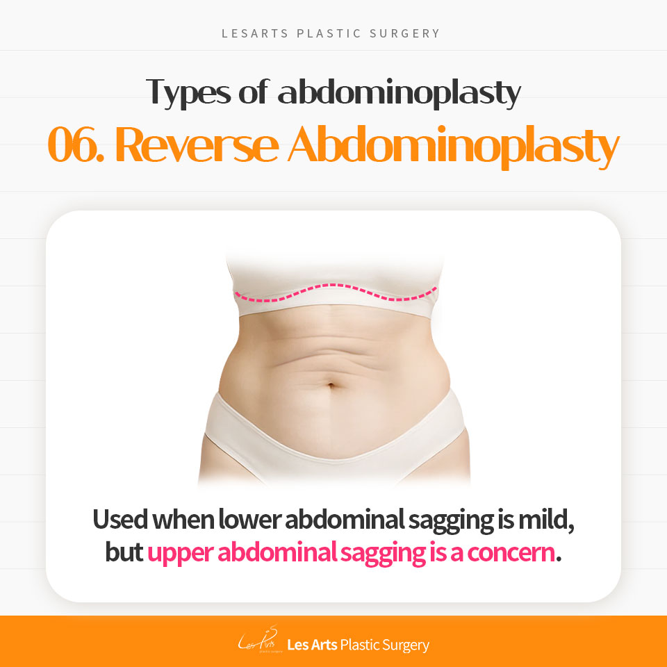 251125_abdominoplasty_post_07