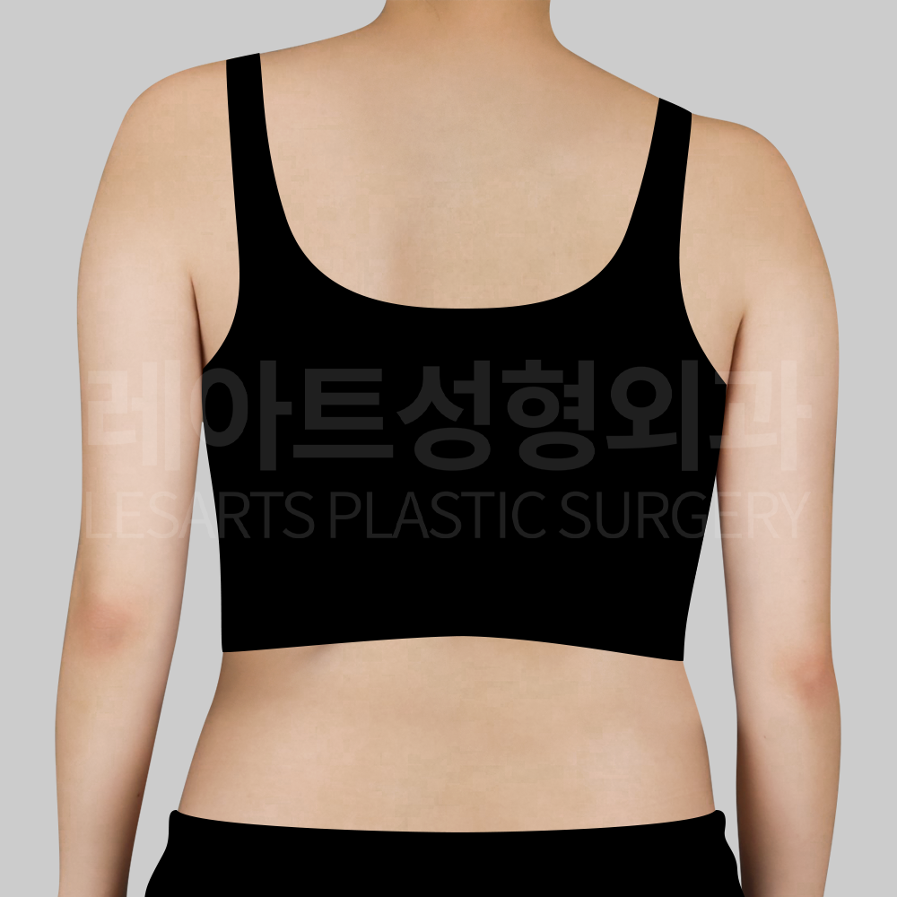 1-2.29696_arm_liposuction_back