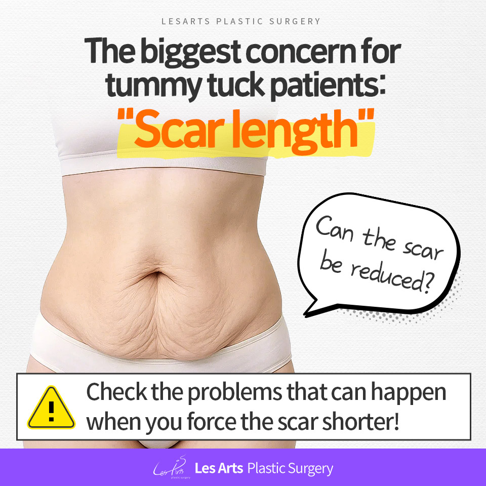 [Abdominoplasty]Why does a tummy tuck inevitably leave a long scar?
