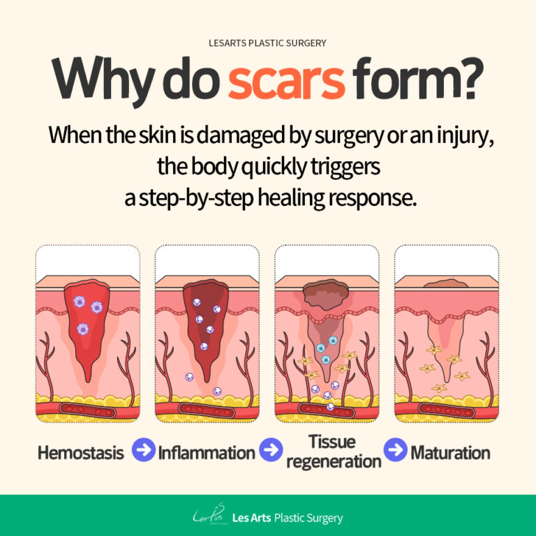 251210_abdominoplasty_post_01
