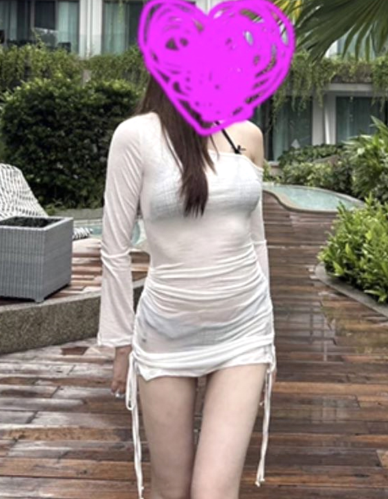 Patrasubung thigh liposuction after surgery in Korea – Lesarts Plastic Surgery