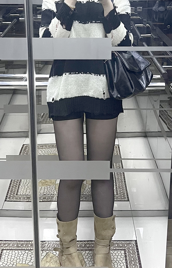 thigh-liposuction-gyongttwin-after