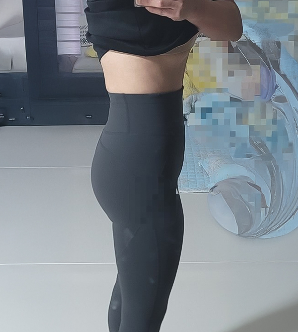 tummy-tuck-thumbnail-kkangjjujju-after