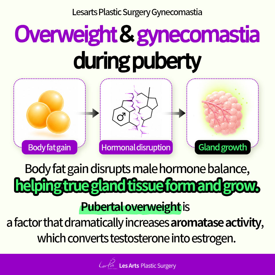 [Gynecomastia]”My Chest? It Started Back in School…”The Hidden Origin of Gynecomastia in Your 20s and 30s:The Connection Between Pubertal Body Changes and Gynecomastia