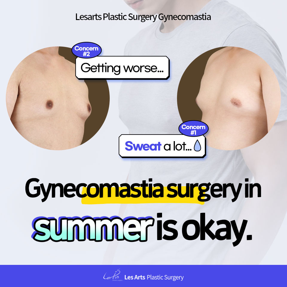[Gynecomastia]”Summer Surgery?!”Should Gynecomastia Surgery Really Be Avoided During Summer?