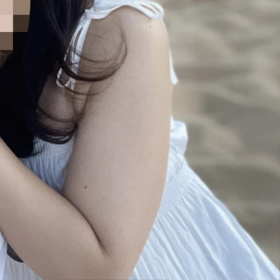 Mutarammutaram arm liposuction before upper arm contour in Korea – Lesarts Plastic Surgery